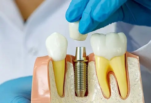 Dental Services